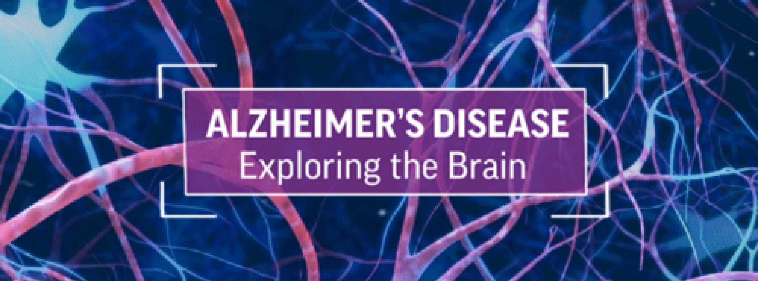 Alzheimer’s Disease: Exploring the Brain